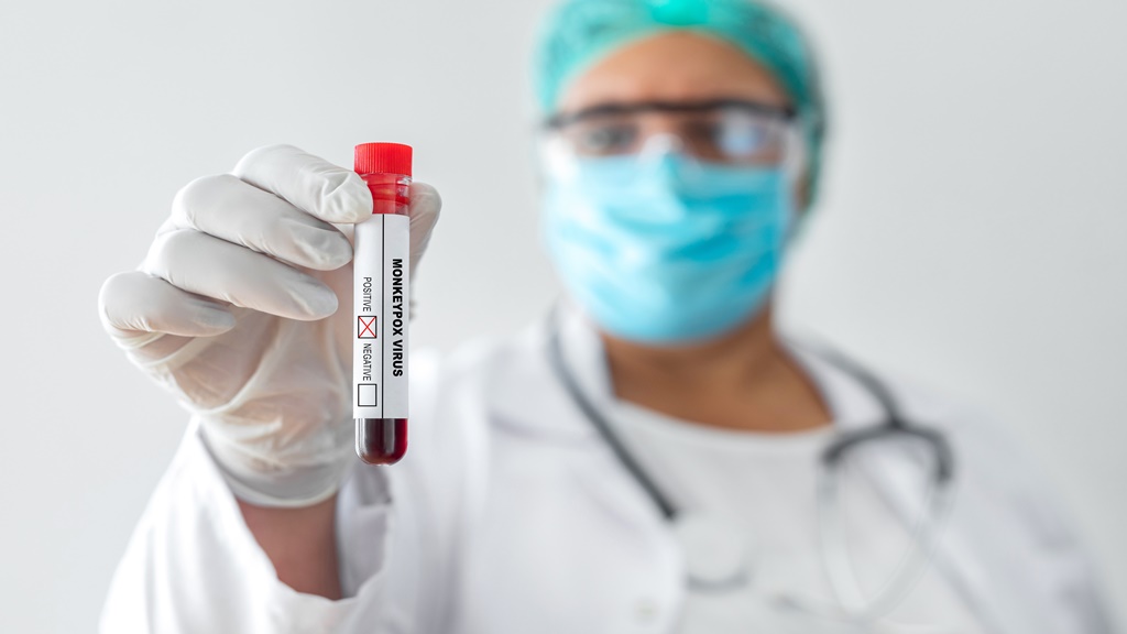 Solo se han puesto a disposición de Ga – Tufton 3.500 dosis de la vacuna contra la viruela del simio