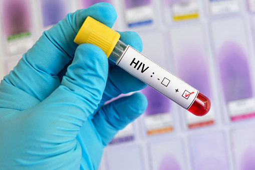 Test de VIH|  Istockphoto